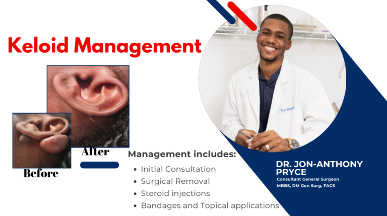 Pryce Keloid 10 768x430