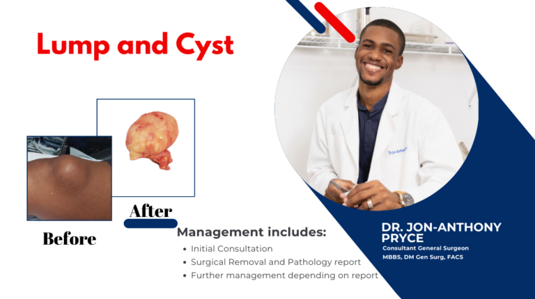 Pryce Keloid 4 768x430